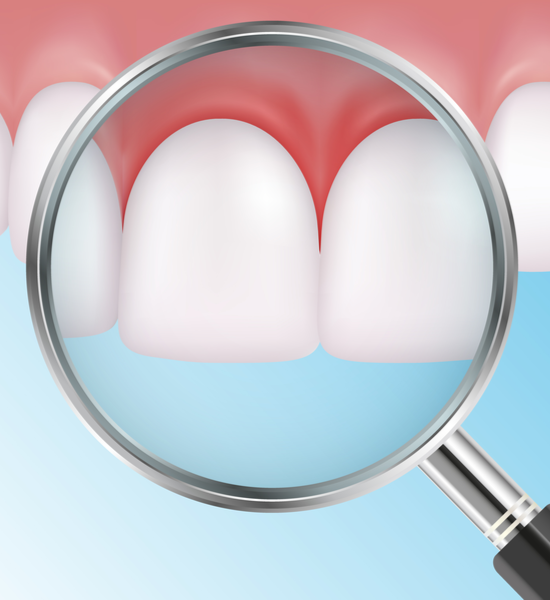 Periodontal Disease | Aristo Dental