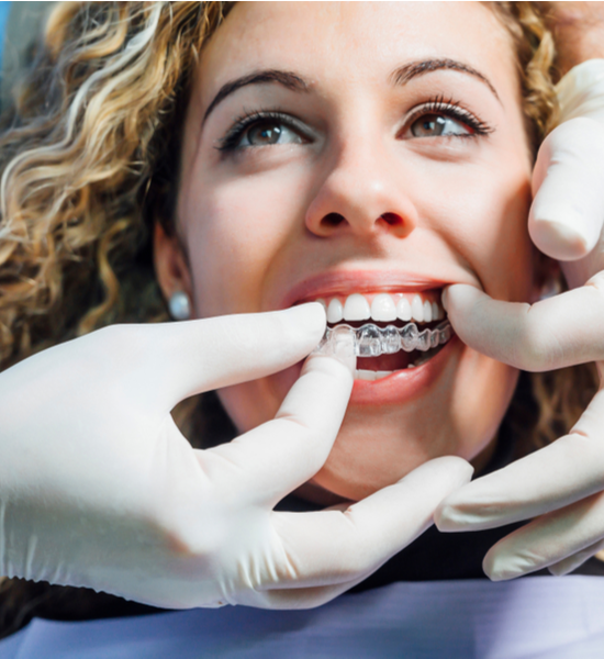 Invisalign Process | Aristo Dental
