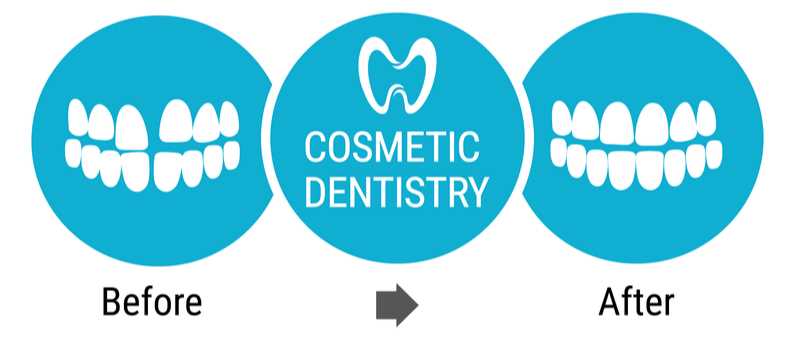 before and after cosmetic dentistry