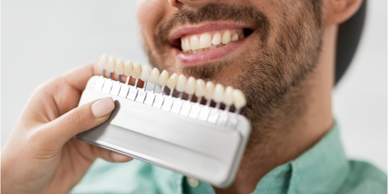 Are Dental Veneers Better than Crowns?