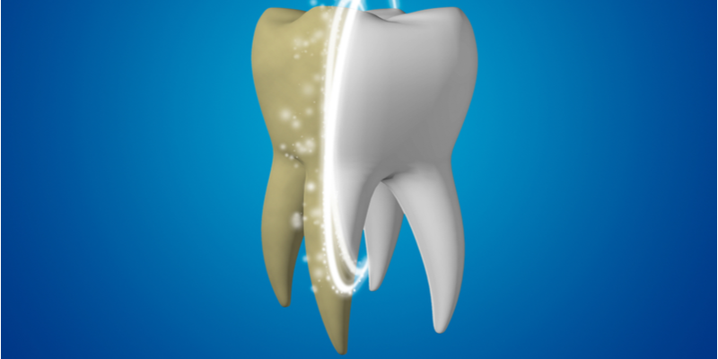 What Can I Do If I Have Yellow Teeth? | Aristo Dental