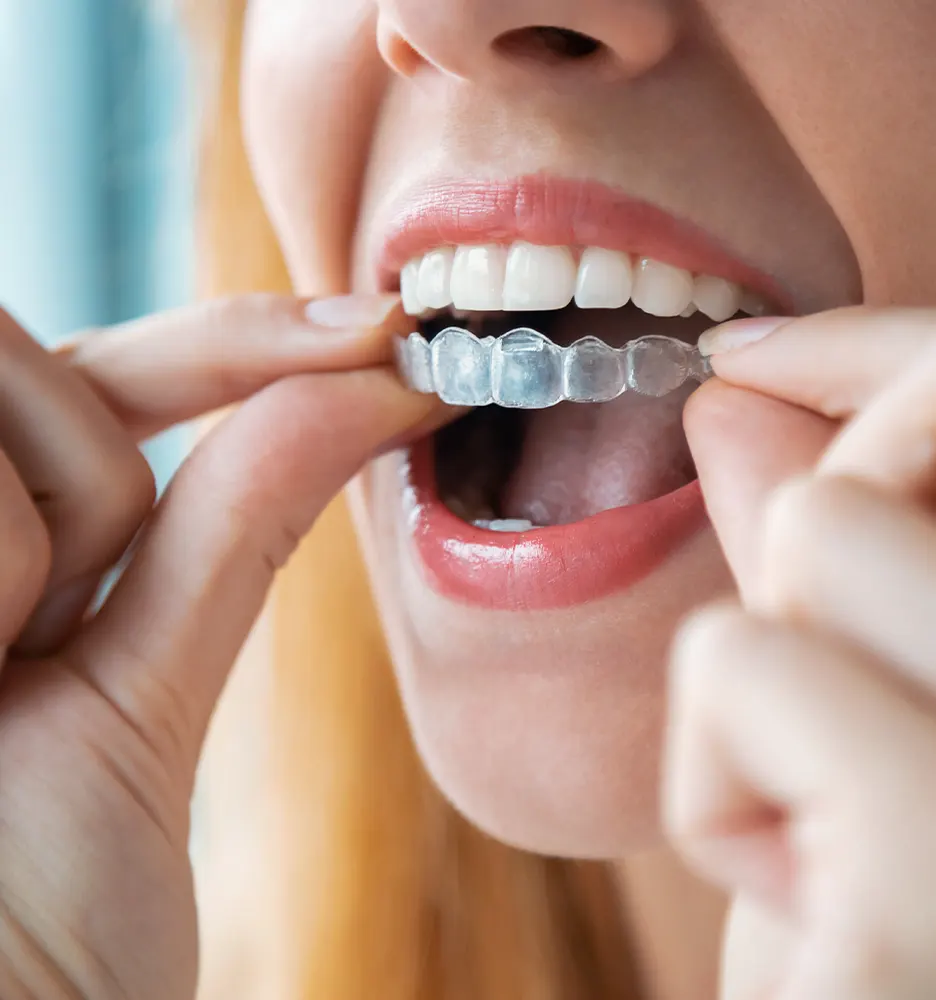 Will Invisalign Be Painful?