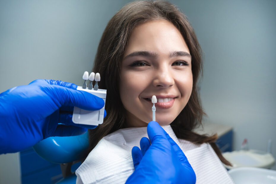 how to care for dental veneers